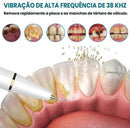 Removedor De Tártaro Limpador Dental Ultrassônico Led