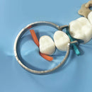 Kit Matriz Dental Restauração Odontológica 100 Peças/